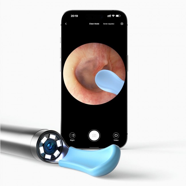 Bebird EarSight R1 Otoscope with camera 180 mAh White Bebird EarSight R1 Otoscope with camera 180 mAh White